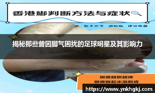 揭秘那些曾因脚气困扰的足球明星及其影响力